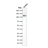 Western Blot - Anti-CD31 Antibody [SPM532] (A249602) - Antibodies.com