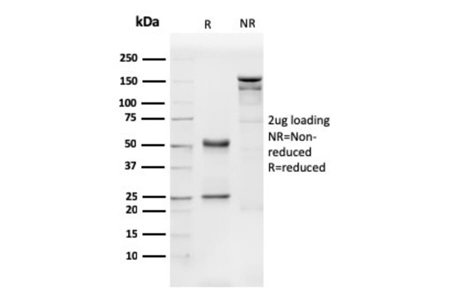 SDS-PAGE - Anti-CD31 Antibody [PECAM1/3540] (A249603) - Antibodies.com