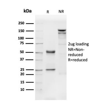 SDS-PAGE - Anti-CD31 Antibody [PECAM1/3540] (A249603) - Antibodies.com