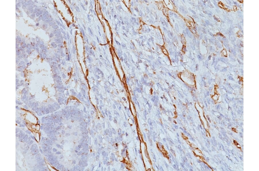 Immunohistochemistry - Anti-CD31 Antibody [JC/70A] (A249604) - Antibodies.com