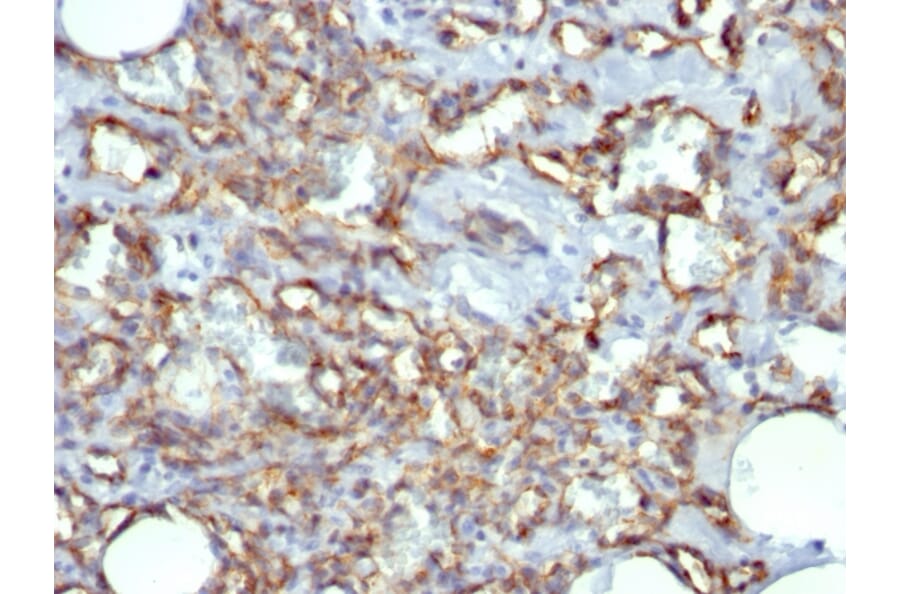 Immunohistochemistry - Anti-CD31 Antibody [JC/70A] (A249604) - Antibodies.com