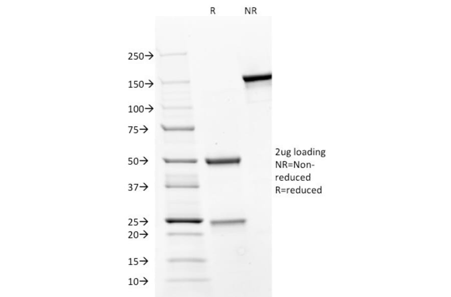 SDS-PAGE - Anti-CD31 Antibody [JC/70A] (A249604) - Antibodies.com