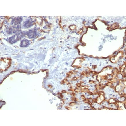 Immunohistochemistry - Anti-CD31 Antibody [SPM122] (A249604) - Antibodies.com