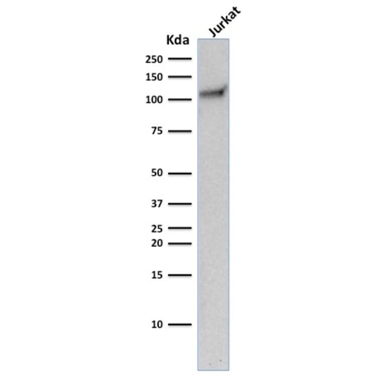 Western Blot - Anti-CD31 Antibody [C31.10] (A249606) - Antibodies.com