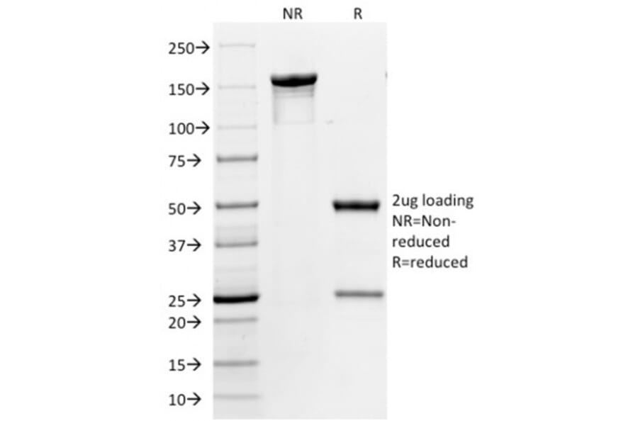 SDS-PAGE - Anti-CD31 Antibody [158-2B3] (A249607) - Antibodies.com