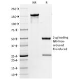 SDS-PAGE - Anti-CD31 Antibody [158-2B3] (A249607) - Antibodies.com