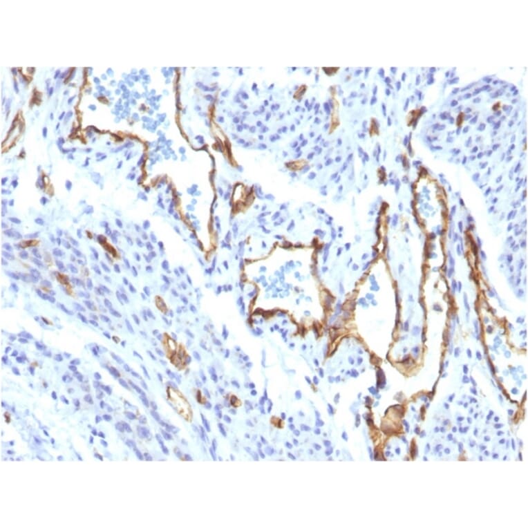 Immunohistochemistry - Anti-CD31 Antibody [C31/1395R] (A249609) - Antibodies.com