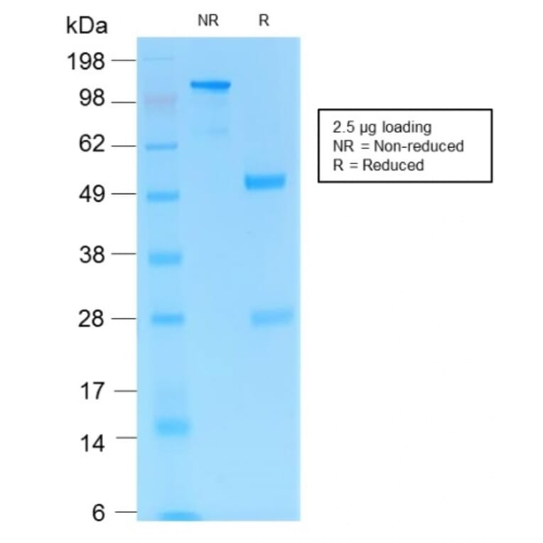 SDS-PAGE - Anti-CD31 Antibody [C31/1395R] (A249609) - Antibodies.com