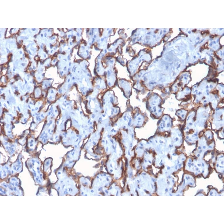 Immunohistochemistry - Anti-CD31 Antibody [C31/2876R] (A249610) - Antibodies.com