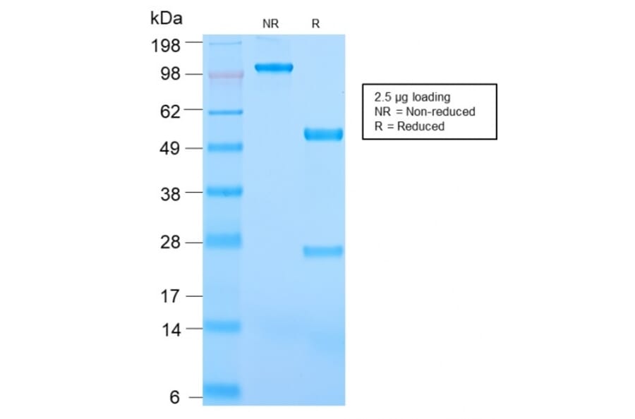 SDS-PAGE - Anti-CD31 Antibody [C31/2876R] (A249610) - Antibodies.com