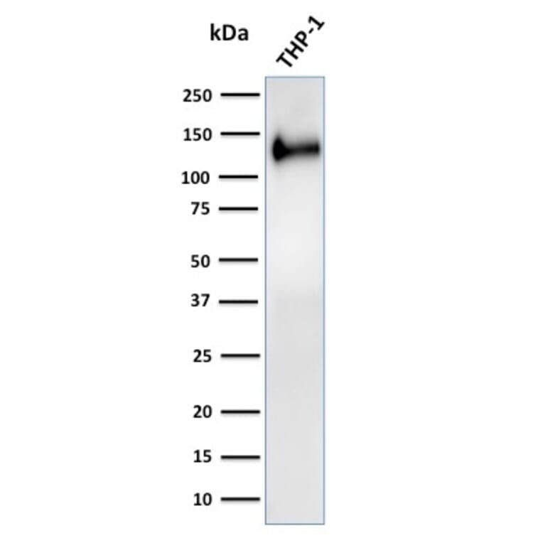 Western Blot - Anti-CD31 Antibody [C31/2876R] (A249610) - Antibodies.com