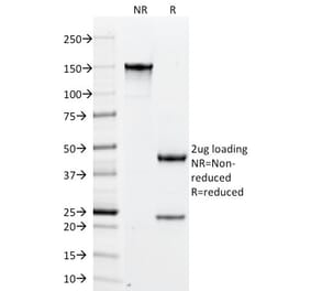 SDS-PAGE - Anti-PLGF Antibody [PLGF/94] (A249611) - Antibodies.com