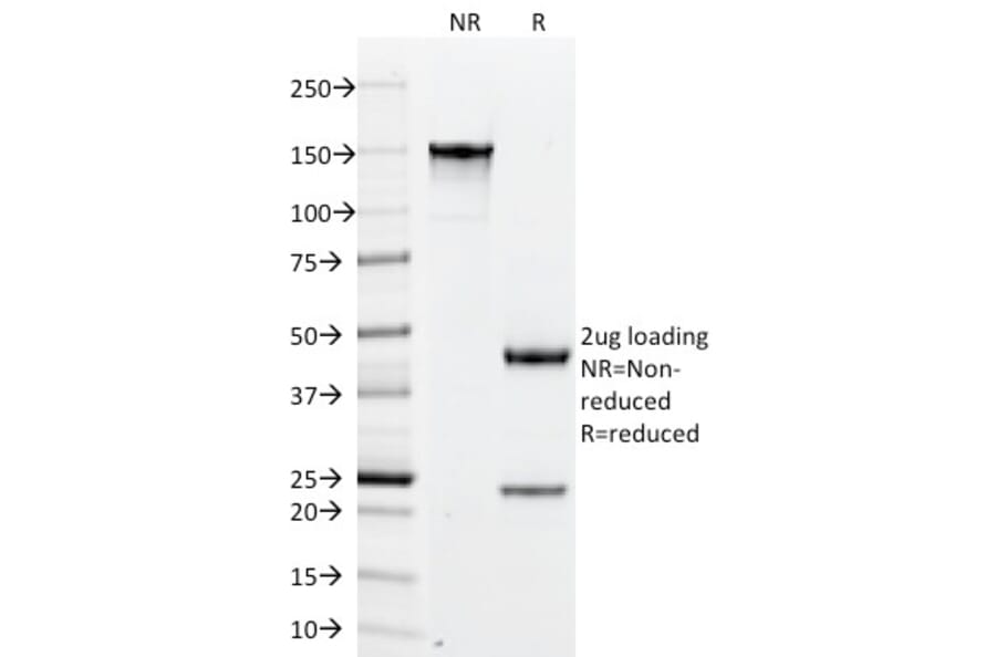 SDS-PAGE - Anti-PLGF Antibody [PLGF/94] (A249611) - Antibodies.com