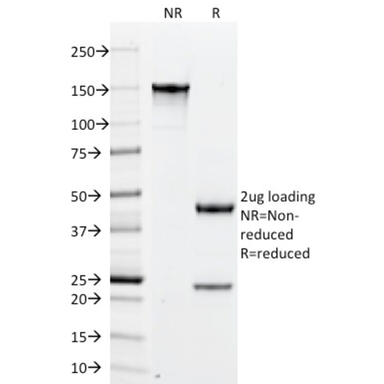 SDS-PAGE - Anti-PLGF Antibody [PLGF/94] (A249611) - Antibodies.com