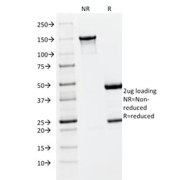 SDS-PAGE - Anti-PLGF Antibody [PLGF/93] (A249612) - Antibodies.com