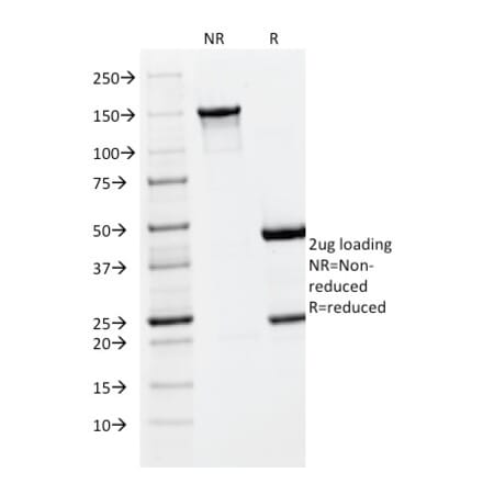 SDS-PAGE - Anti-PLGF Antibody [PLGF/93] (A249612) - Antibodies.com