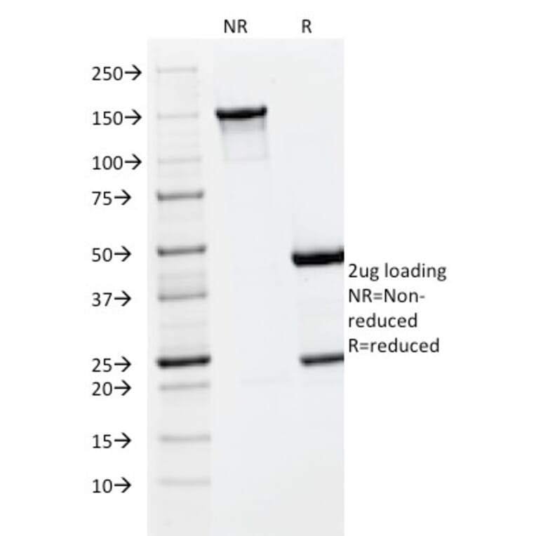 SDS-PAGE - Anti-PLGF Antibody [PLGF/93] (A249612) - Antibodies.com