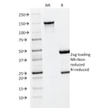 SDS-PAGE - Anti-PLGF Antibody [PLGF/93] (A249612) - Antibodies.com