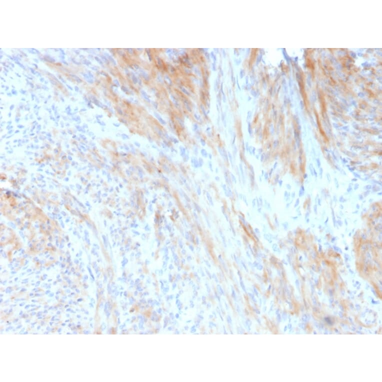 Immunohistochemistry - Anti-Phosphoglucomutase 5 Antibody [14F8/F8] (A249614) - Antibodies.com