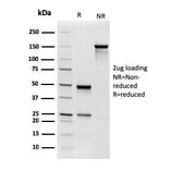 SDS-PAGE - Anti-Phosphoglucomutase 5 Antibody [14F8/F8] (A249614) - Antibodies.com