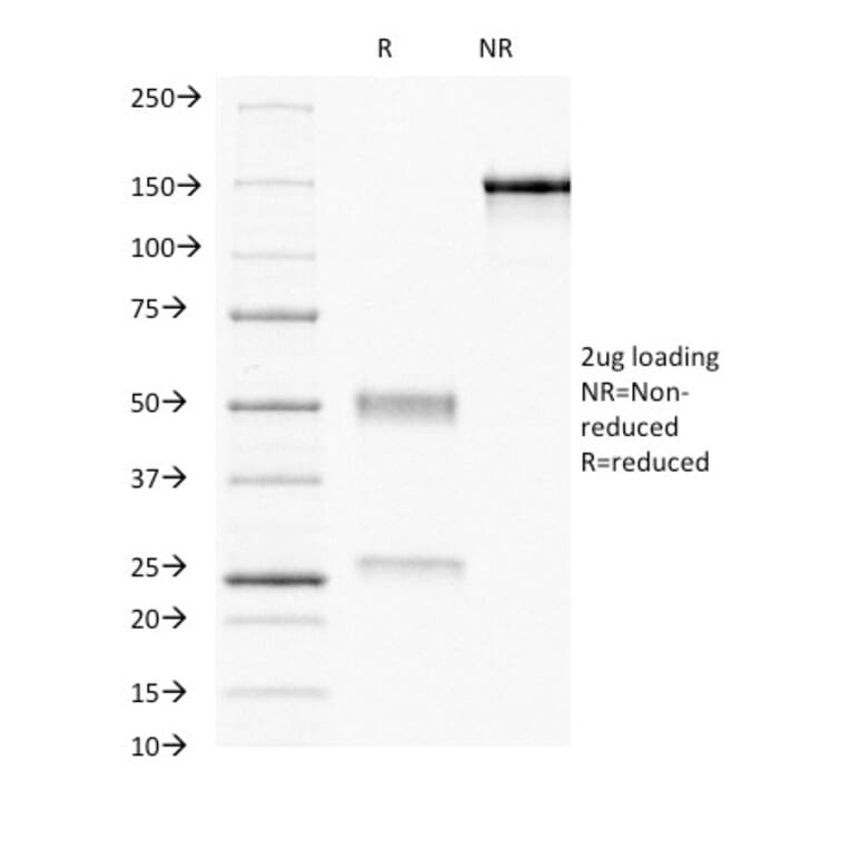 SDS-PAGE - Anti-Progesterone Receptor Antibody [PR484] (A249615) - Antibodies.com