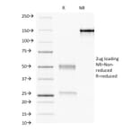 SDS-PAGE - Anti-Progesterone Receptor Antibody [PR484] (A249615) - Antibodies.com
