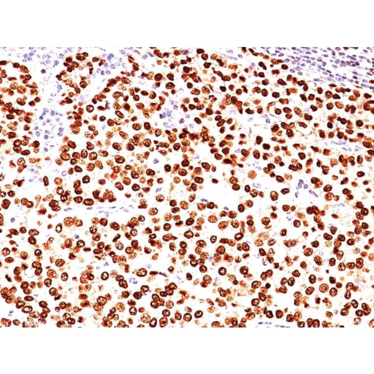 Immunohistochemistry - Anti-Progesterone Receptor Antibody [SPM566] (A249615) - Antibodies.com