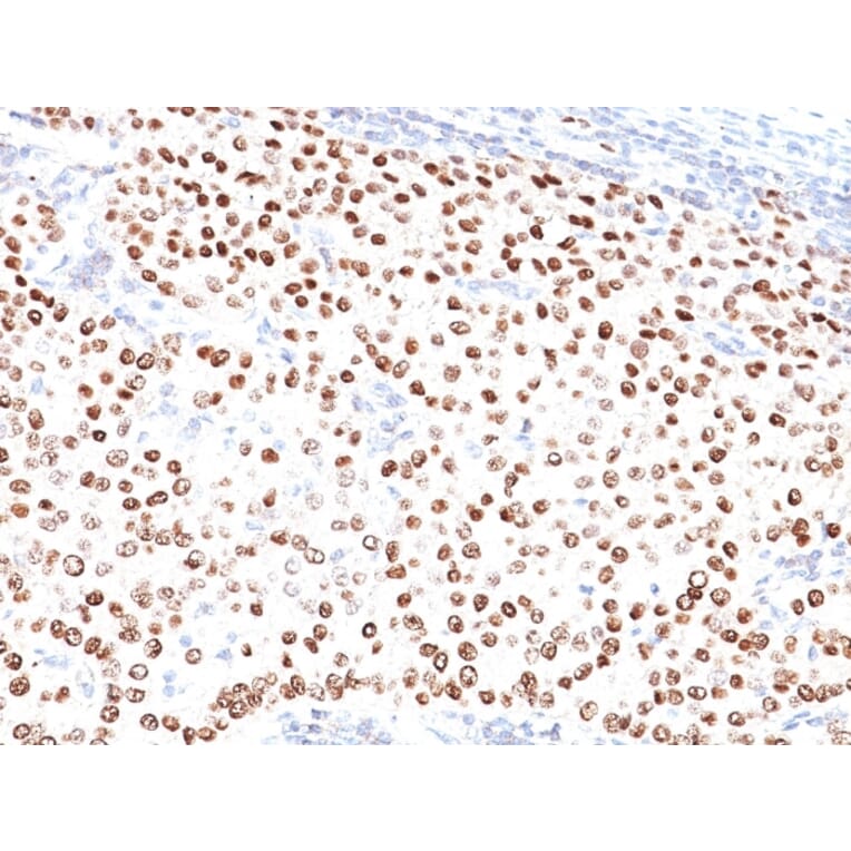 Immunohistochemistry - Anti-Progesterone Receptor Antibody [PR500] (A249616) - Antibodies.com