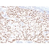 Immunohistochemistry - Anti-Progesterone Receptor Antibody [PR500] (A249616) - Antibodies.com