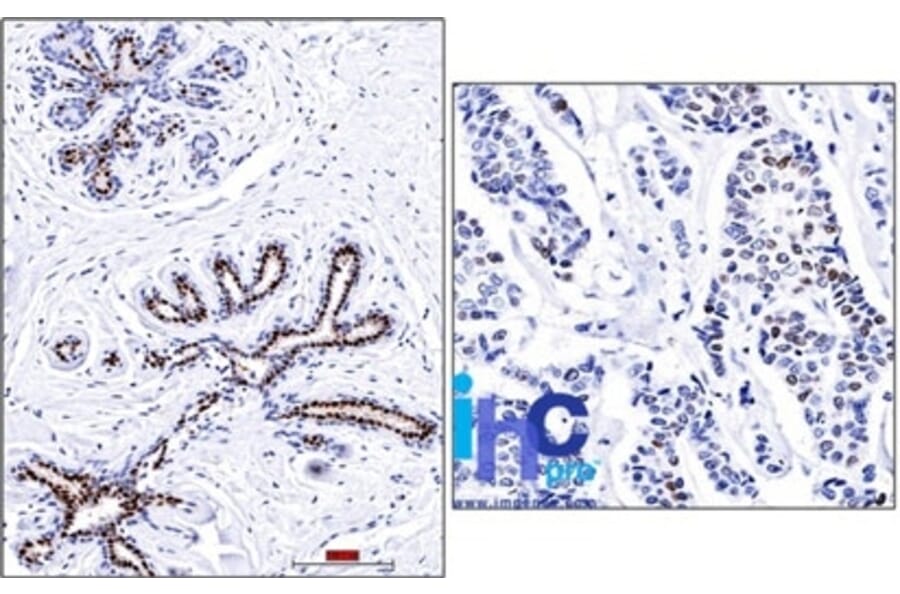 Immunohistochemistry - Anti-Progesterone Receptor Antibody [PR501] (A249617) - Antibodies.com