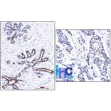 Immunohistochemistry - Anti-Progesterone Receptor Antibody [PR501] (A249617) - Antibodies.com
