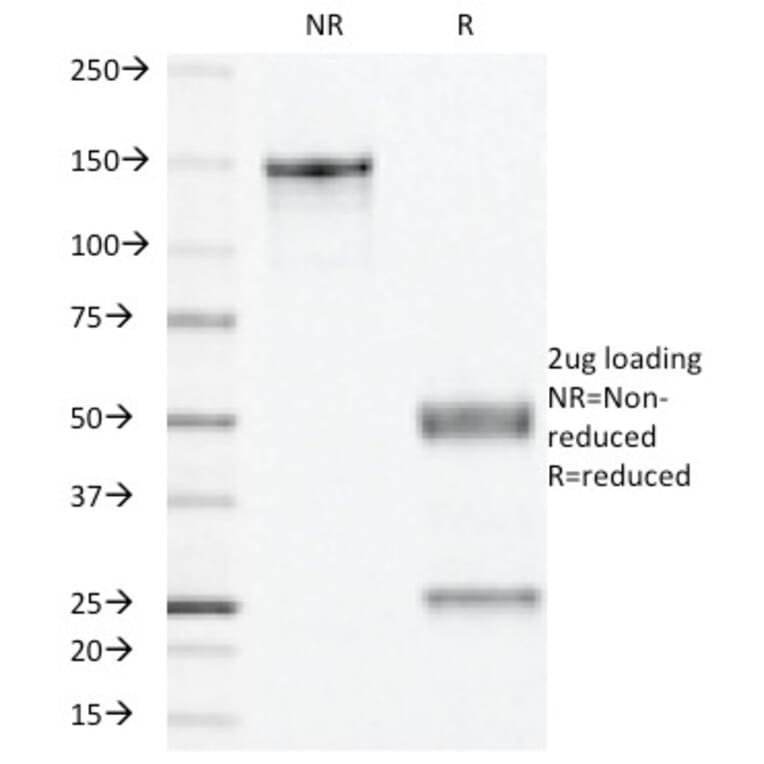 SDS-PAGE - Anti-Progesterone Receptor Antibody [PR501] (A249618) - Antibodies.com