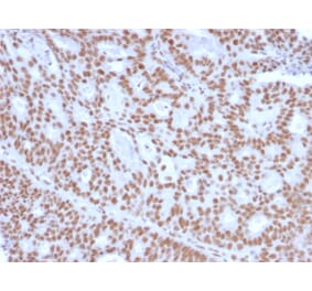 Immunohistochemistry - Anti-Progesterone Receptor Antibody [PGR/2694] (A249619) - Antibodies.com