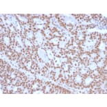 Immunohistochemistry - Anti-Progesterone Receptor Antibody [PGR/2694] (A249619) - Antibodies.com