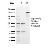 SDS-PAGE - Anti-Progesterone Receptor Antibody [PGR/2694] (A249619) - Antibodies.com