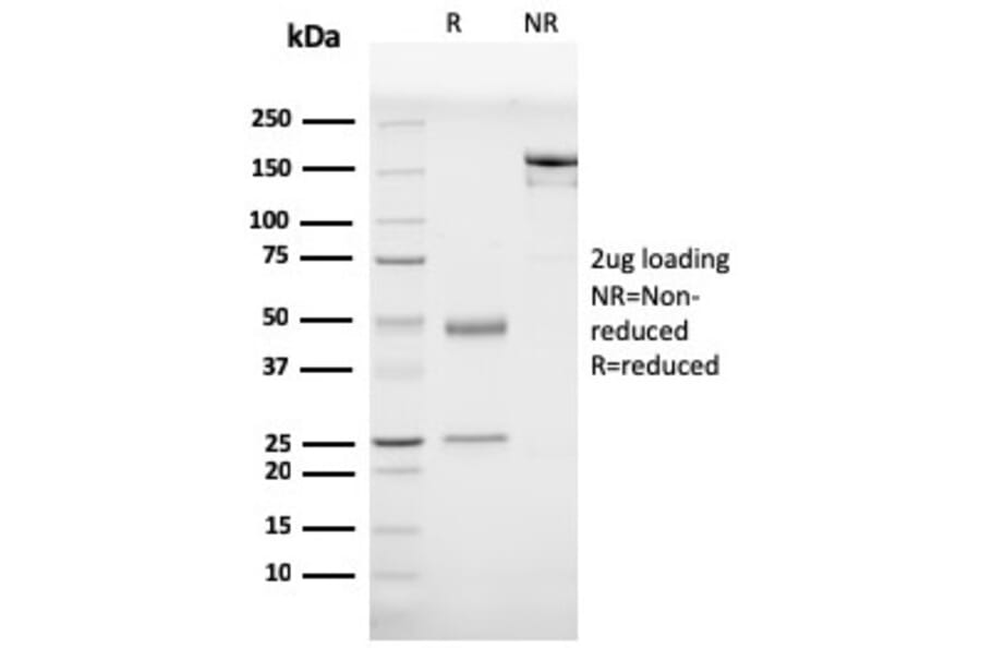 SDS-PAGE - Anti-Prohibitin Antibody [PHB/3230] (A249620) - Antibodies.com
