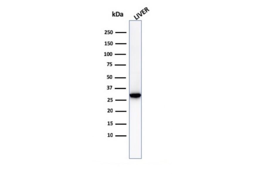 Western Blot - Anti-Prohibitin Antibody [PHB/3230] (A249620) - Antibodies.com