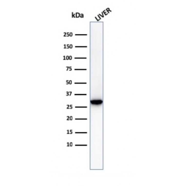 Western Blot - Anti-Prohibitin Antibody [PHB/3230] (A249620) - Antibodies.com