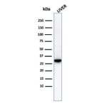 Western Blot - Anti-Prohibitin Antibody [PHB/3230] (A249620) - Antibodies.com