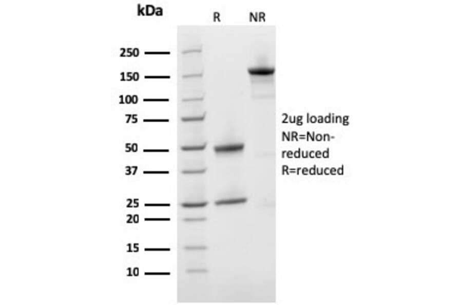 SDS-PAGE - Anti-Prohibitin Antibody [PHB/3231] (A249621) - Antibodies.com
