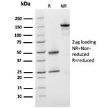 SDS-PAGE - Anti-Prohibitin Antibody [PHB/3231] (A249621) - Antibodies.com