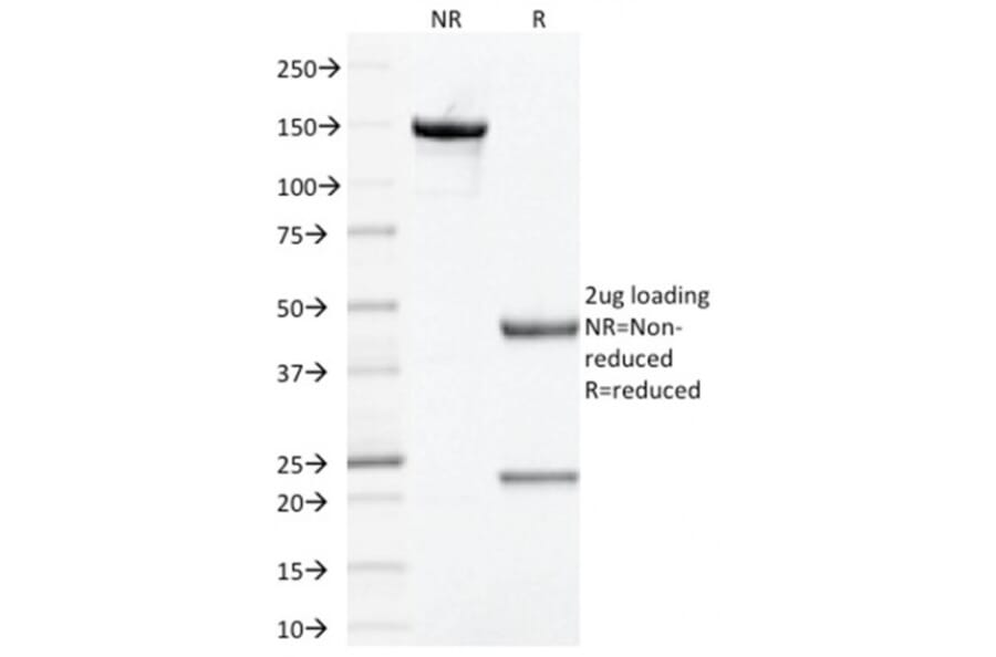 SDS-PAGE - Anti-Prohibitin Antibody [PHB/1881] (A249622) - Antibodies.com