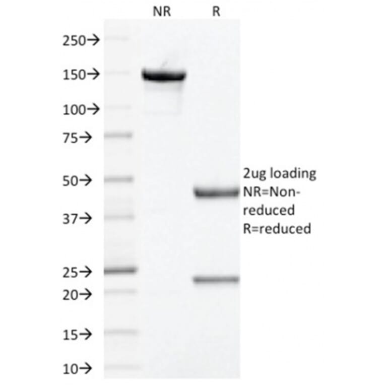 SDS-PAGE - Anti-Prohibitin Antibody [PHB/1881] (A249622) - Antibodies.com