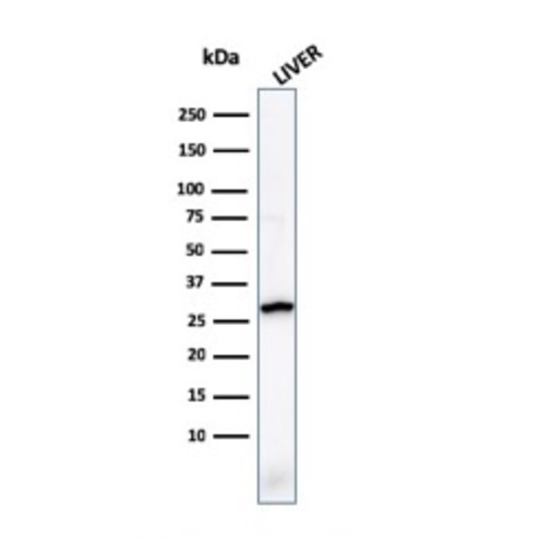 Western Blot - Anti-Prohibitin Antibody [PHB/1881] (A249622) - Antibodies.com