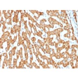 Immunohistochemistry - Anti-Prohibitin Antibody [PHB/1882] (A249623) - Antibodies.com