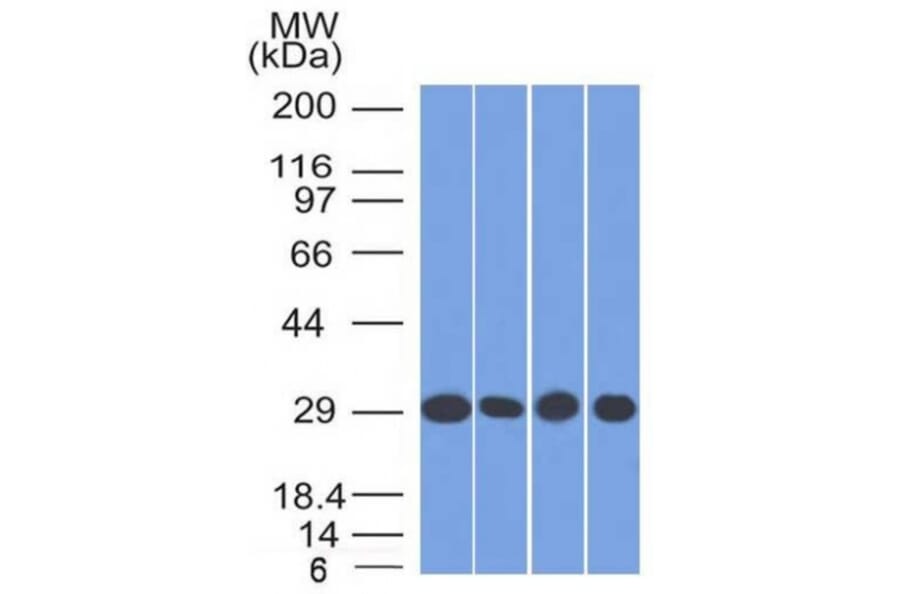 Western Blot - Anti-Prohibitin Antibody [PHB/1882] (A249624) - Antibodies.com