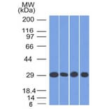 Western Blot - Anti-Prohibitin Antibody [PHB/1882] (A249624) - Antibodies.com