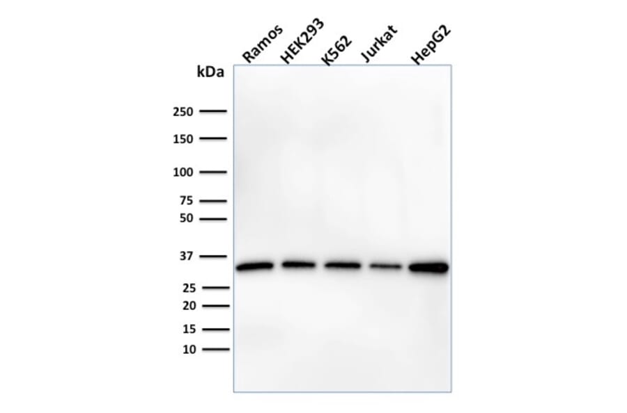 Western Blot - Anti-Prohibitin Antibody [PHB/1882] (A249624) - Antibodies.com