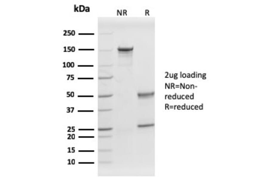 SDS-PAGE - Anti-Prohibitin Antibody [PHB/1882] (A249624) - Antibodies.com