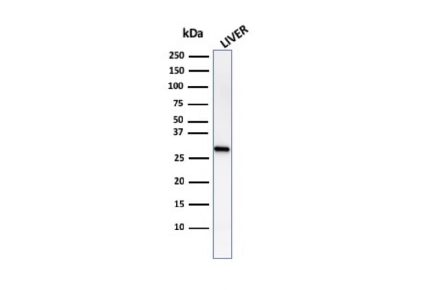 Western Blot - Anti-Prohibitin Antibody [PHB/1882] (A249624) - Antibodies.com